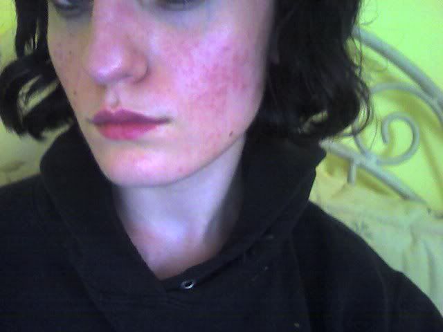 Red Itchy Face