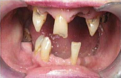 teeth Pictures, Images and Photos